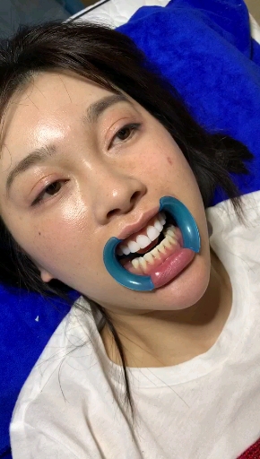 牙齿美白#小姐姐的牙齿太漂亮了!一开口就赢了!精致人生!品质生活!