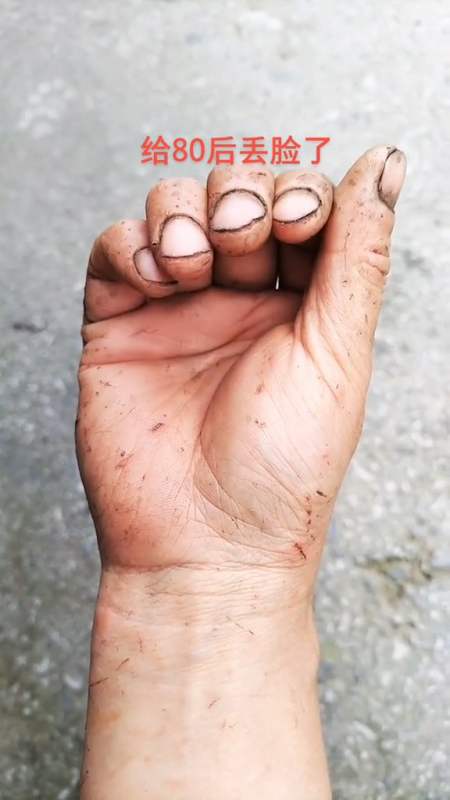 我晒一下自己养的手只有满手的伤痕洗不掉的老茧给80后丢脸了