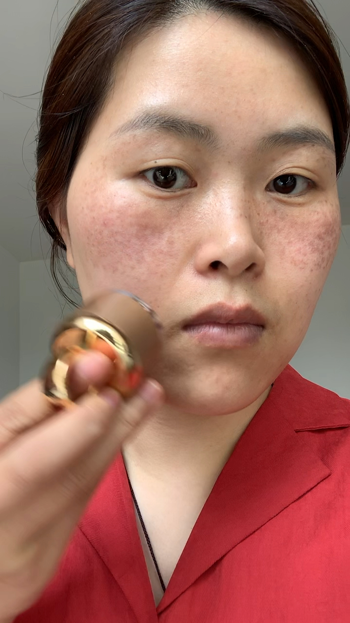 六年的麻子脸.两个多月的改变!