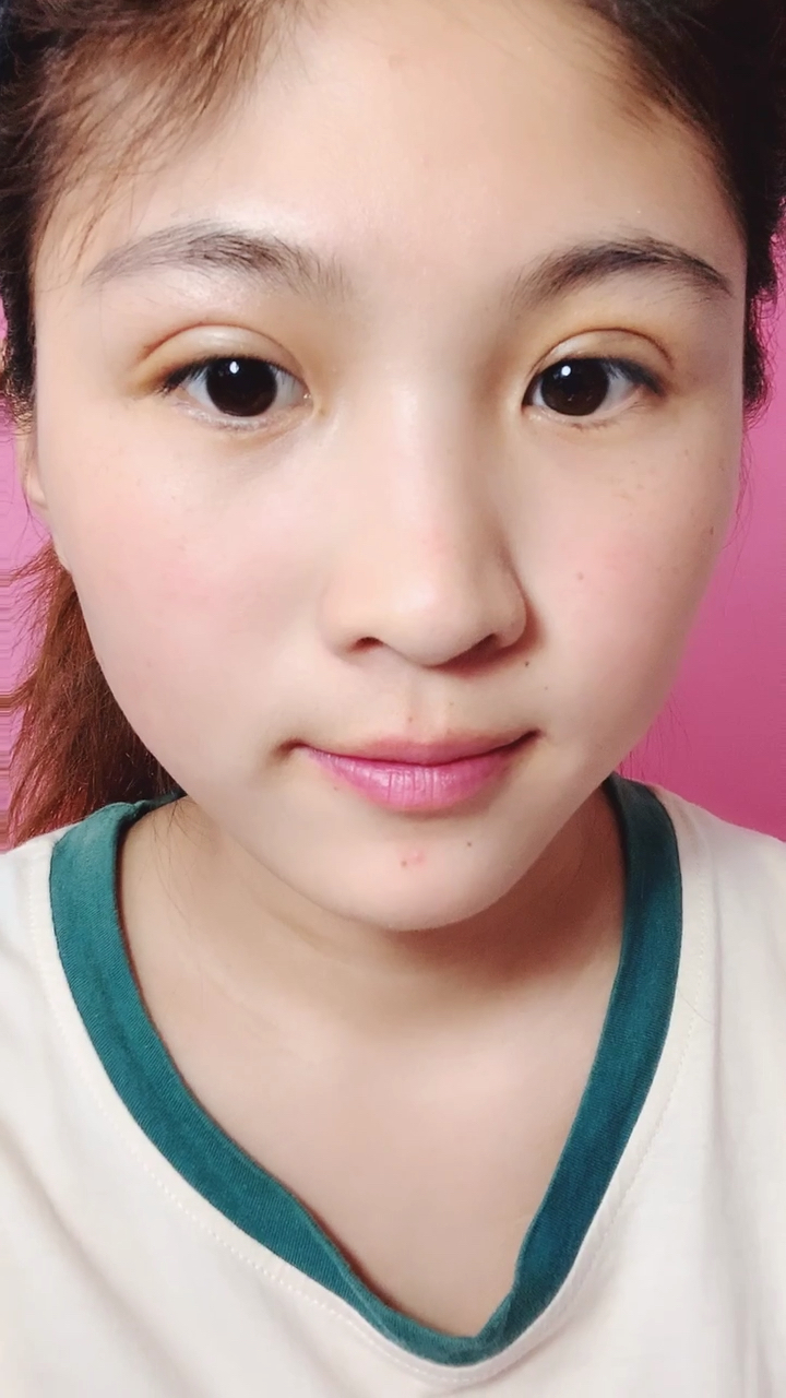 都说我割双眼皮失败了,有这么夸张吗