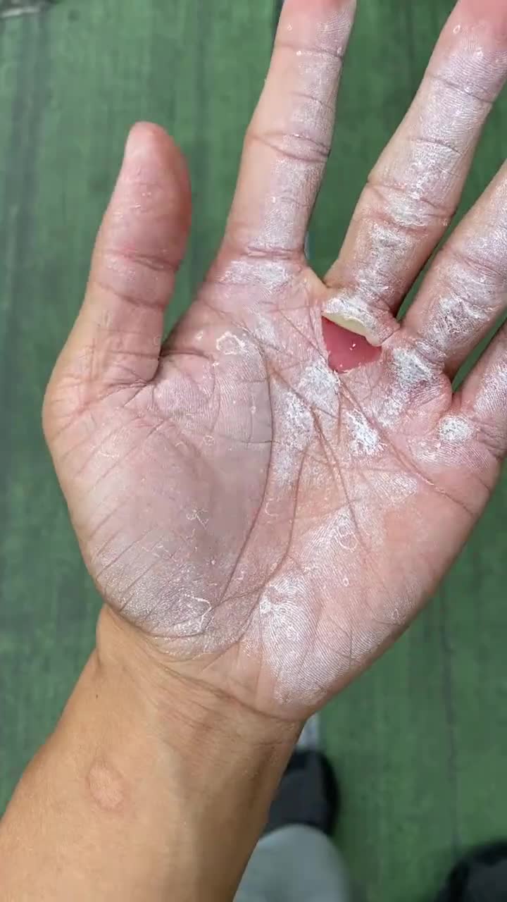 奥运冠军的手人生没有捷径背后的努力只有自己知道