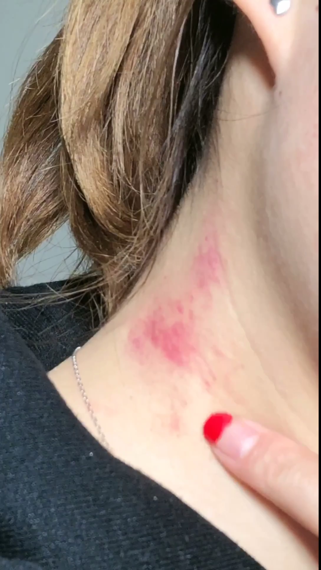 生活小技巧#这样做轻松去除草莓印