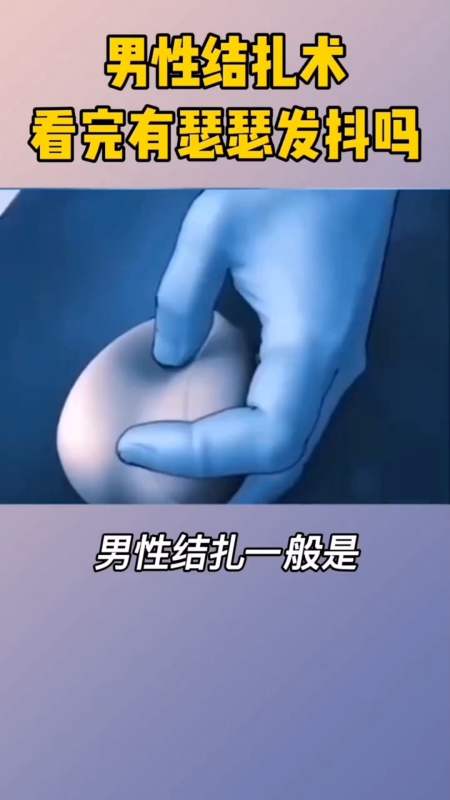 男性結紮手術看完你怕了嗎