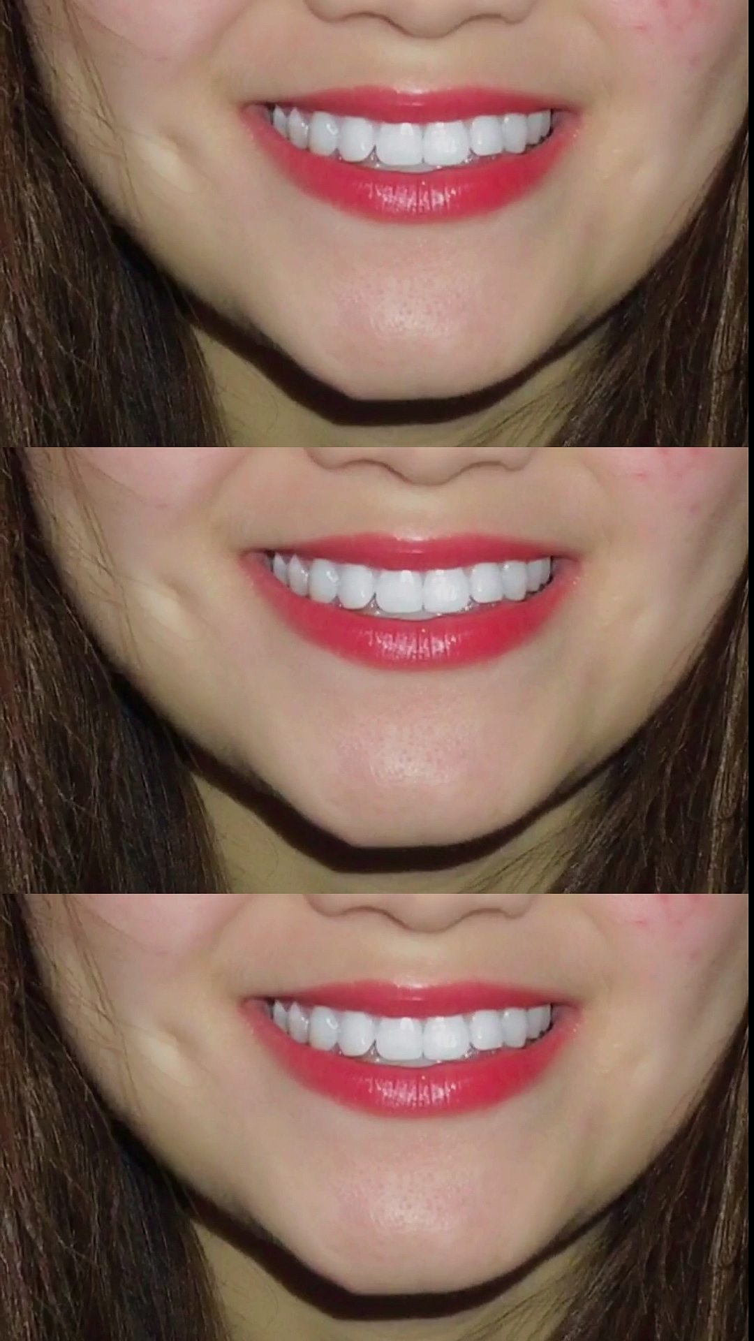 我要上热门#拥有一口白牙吧