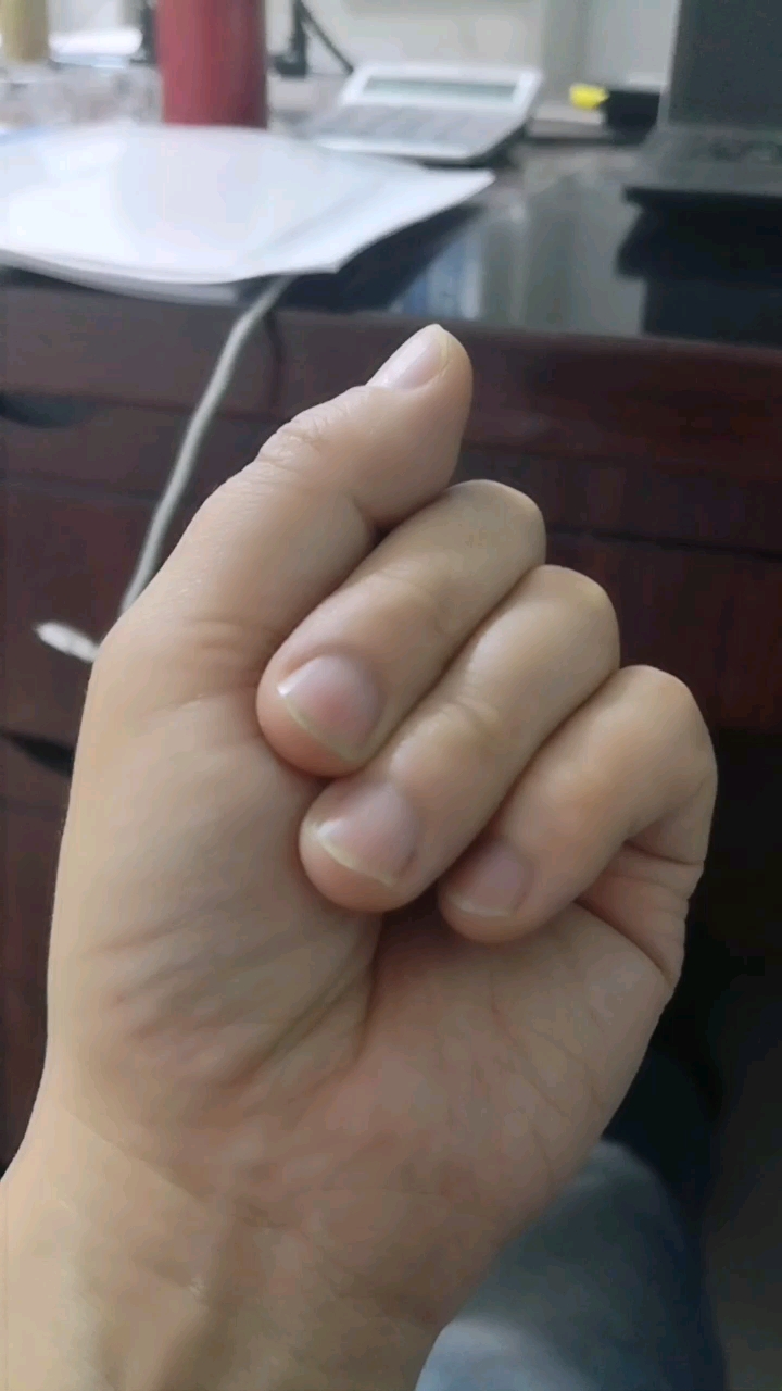 搞得谁不是四个指头一样,我不也没自卑吗!