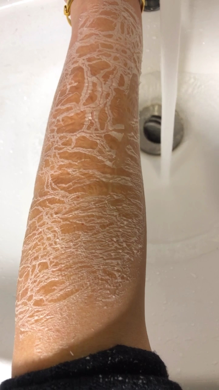 皮肤干燥粗糙洗干净,老公惊呆了